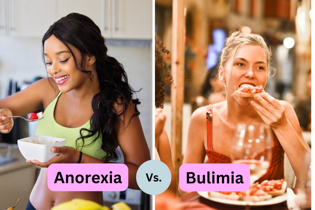 Difference between Anorexia and Bulimia